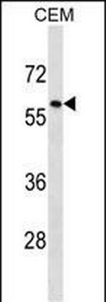 TRIM58 Antibody in Western Blot (WB)