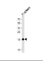 RNASE2 Polyclonal Antibody