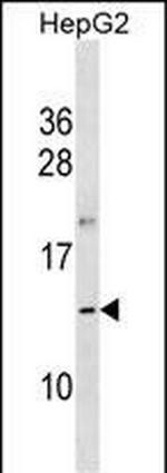 OOSP1 Polyclonal Antibody