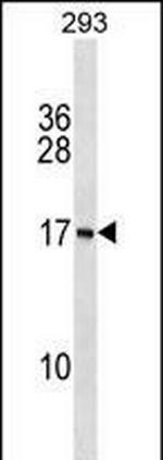 PAPPAS Polyclonal Antibody