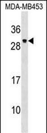 PDF Polyclonal Antibody