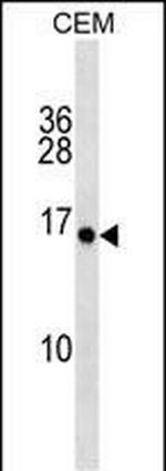 PLGLA Polyclonal Antibody