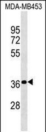 PSG4 Polyclonal Antibody
