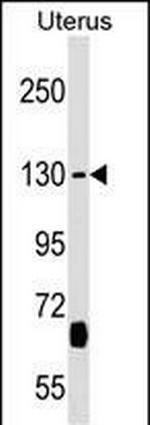 KIF27 Polyclonal Antibody