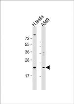 HSPB9 Polyclonal Antibody