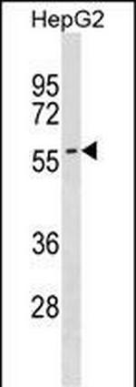 SMPD3 Polyclonal Antibody