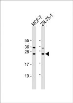 STAG3L1 Antibody in Western Blot (WB)