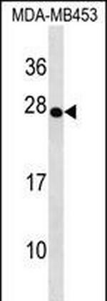 TRDC Polyclonal Antibody