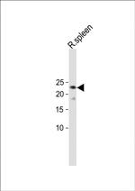 TRGC2 Polyclonal Antibody