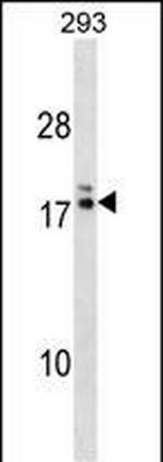 HIATL2 Polyclonal Antibody