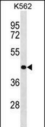 ZNF73 Polyclonal Antibody