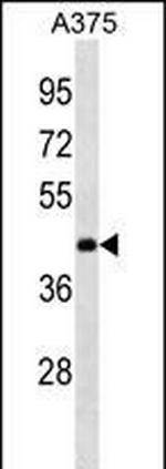 ANKRD63 Polyclonal Antibody