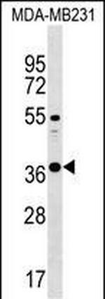 CTRB1 Polyclonal Antibody