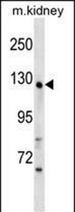 WDR64 Polyclonal Antibody