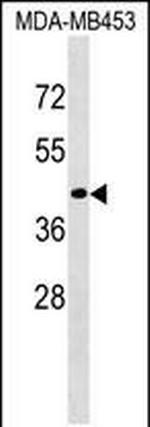 CD200R1L Polyclonal Antibody