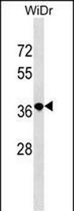 RRN3P2 Polyclonal Antibody