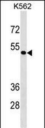 ZNF733 Antibody in Western Blot (WB)