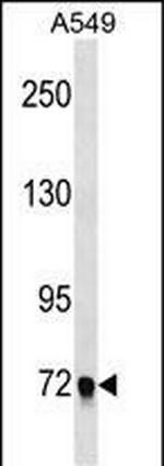 EPB41L5 Polyclonal Antibody
