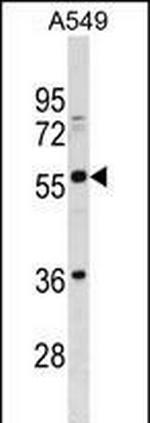 BTN2A3P Polyclonal Antibody