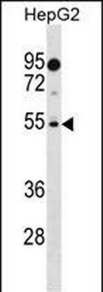 PRAMEF18 Polyclonal Antibody