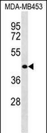 WASH2P Polyclonal Antibody