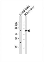 SLC30A10 Polyclonal Antibody
