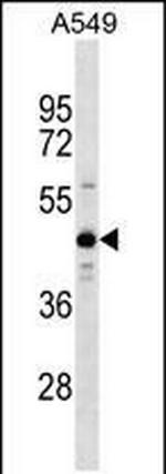 ZNF883 Polyclonal Antibody