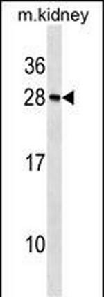 Recoverin Polyclonal Antibody