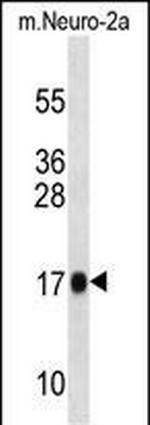 RPL13A Polyclonal Antibody