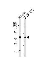 AKTIP Polyclonal Antibody