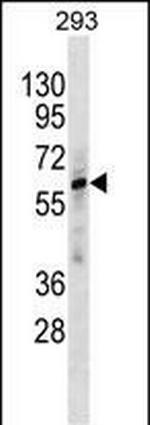 ZNF775 Antibody in Western Blot (WB)