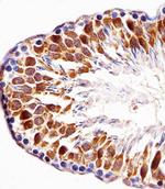 PBK Polyclonal Antibody