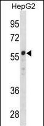ZNF276 Polyclonal Antibody