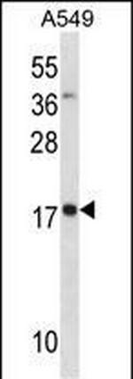 MYL4 Polyclonal Antibody
