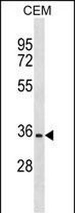 OR2A12 Polyclonal Antibody
