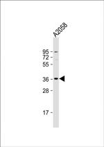 OR52J3 Polyclonal Antibody