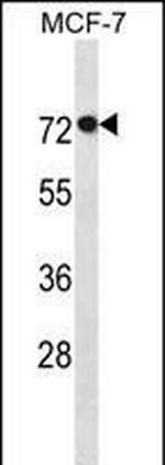 AGAP11 Polyclonal Antibody
