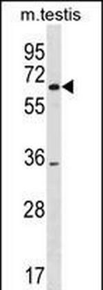 SRRM3 Polyclonal Antibody
