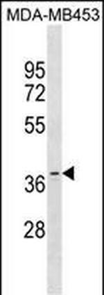 OR11A1 Polyclonal Antibody