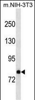 DAB2 Polyclonal Antibody