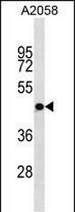 OR4S1 Polyclonal Antibody