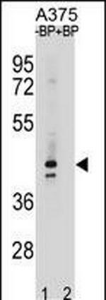 OR5AC2 Polyclonal Antibody