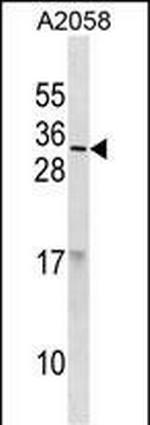RNASE9 Polyclonal Antibody