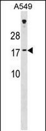 SSX7 Polyclonal Antibody