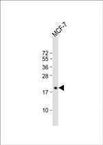 SEC11A Polyclonal Antibody