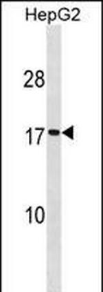 SEC11A Antibody in Western Blot (WB)