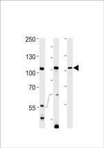 TFIP11 Antibody in Western Blot (WB)