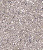 TXNIP Polyclonal Antibody