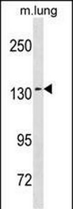 SEC31A Polyclonal Antibody