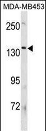 ATP8B3 Polyclonal Antibody